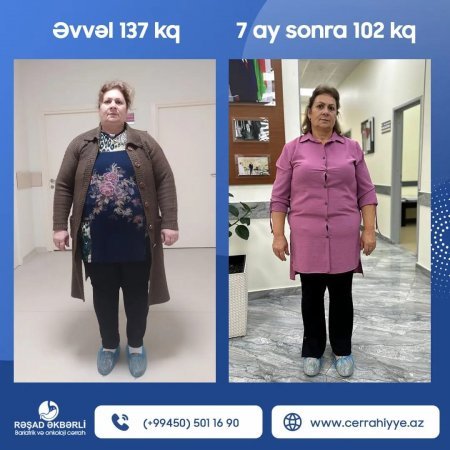 Bariatrik və Onkoloji cərrah Op.dr. Rəşad Əkbərli