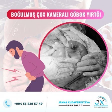 Dr. Janna Xudaverdiyeva Şəhid ailələrinə, qazı ailəsinə təmənnasız xidmət göstərir və diqqət mərkəzində saxlayır