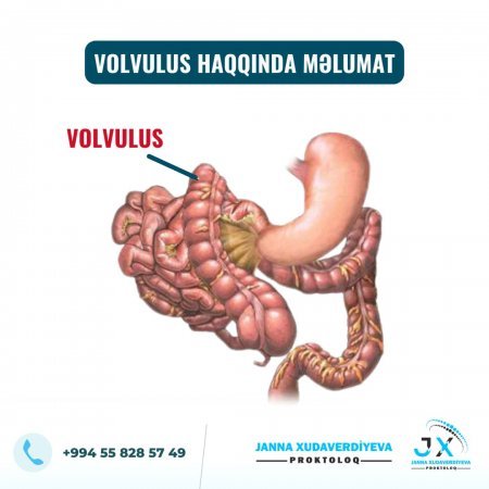 Dr. Janna Xudaverdiyeva Şəhid ailələrinə, qazı ailəsinə təmənnasız xidmət göstərir və diqqət mərkəzində saxlayır