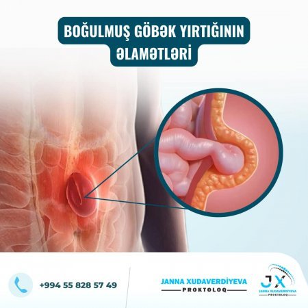 Dr. Janna Xudaverdiyeva Şəhid ailələrinə, qazı ailəsinə təmənnasız xidmət göstərir və diqqət mərkəzində saxlayır