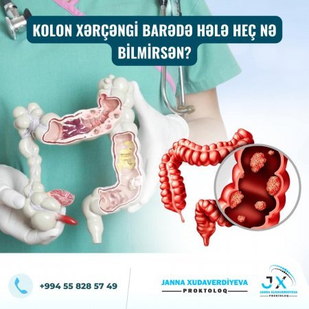 Dr. Janna Xudaverdiyeva Şəhid ailələrinə, qazı ailəsinə təmənnasız xidmət göstərir və diqqət mərkəzində saxlayır